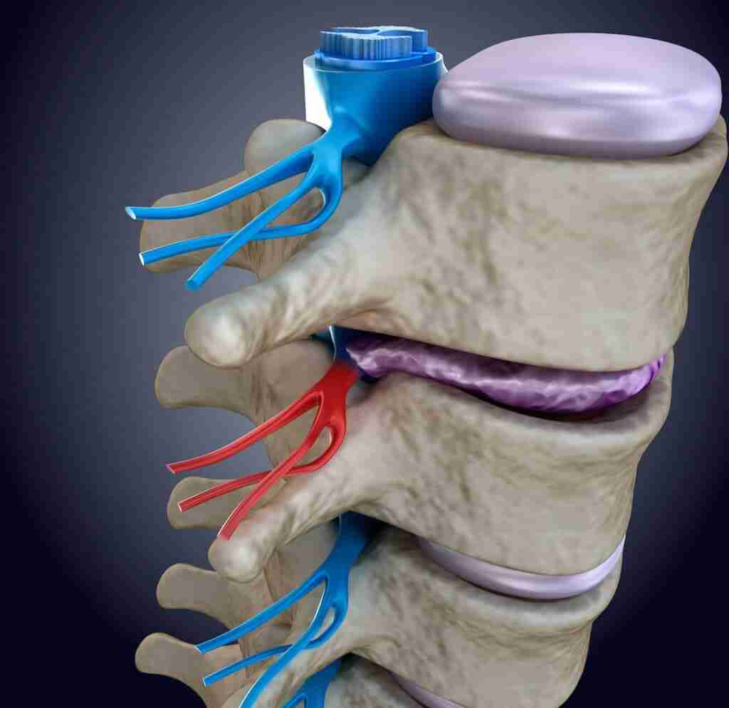 Spinal Cord Injury