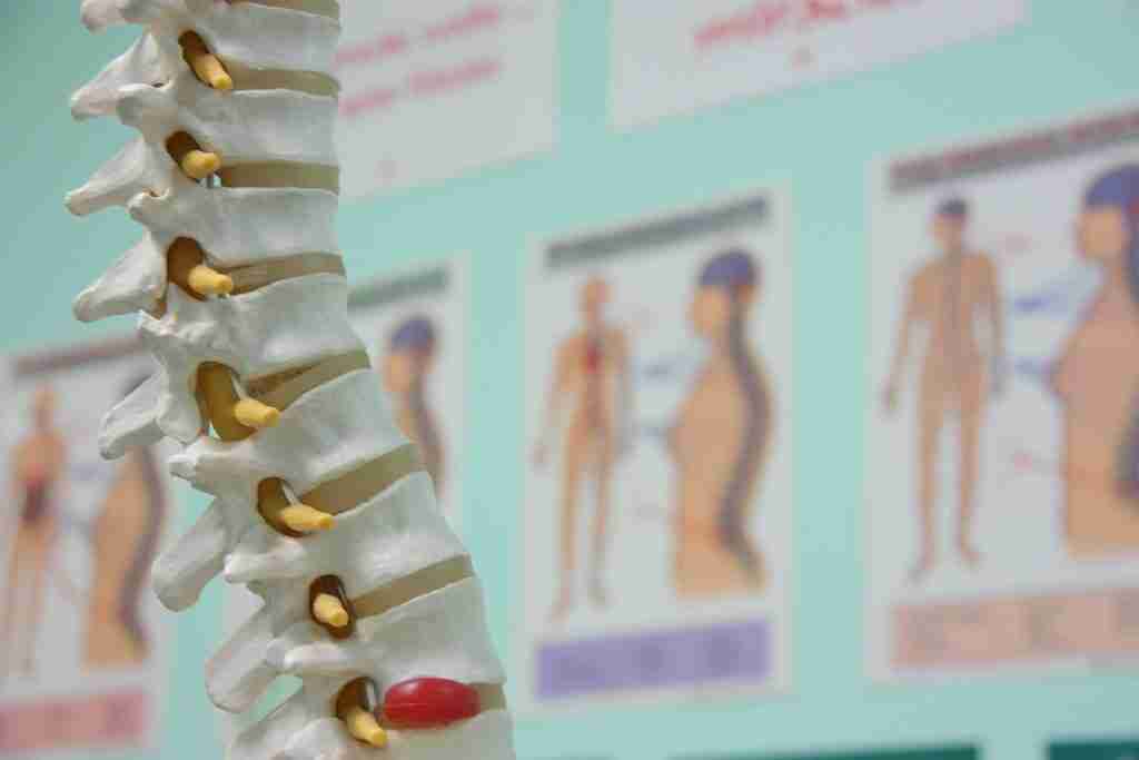 Herniation